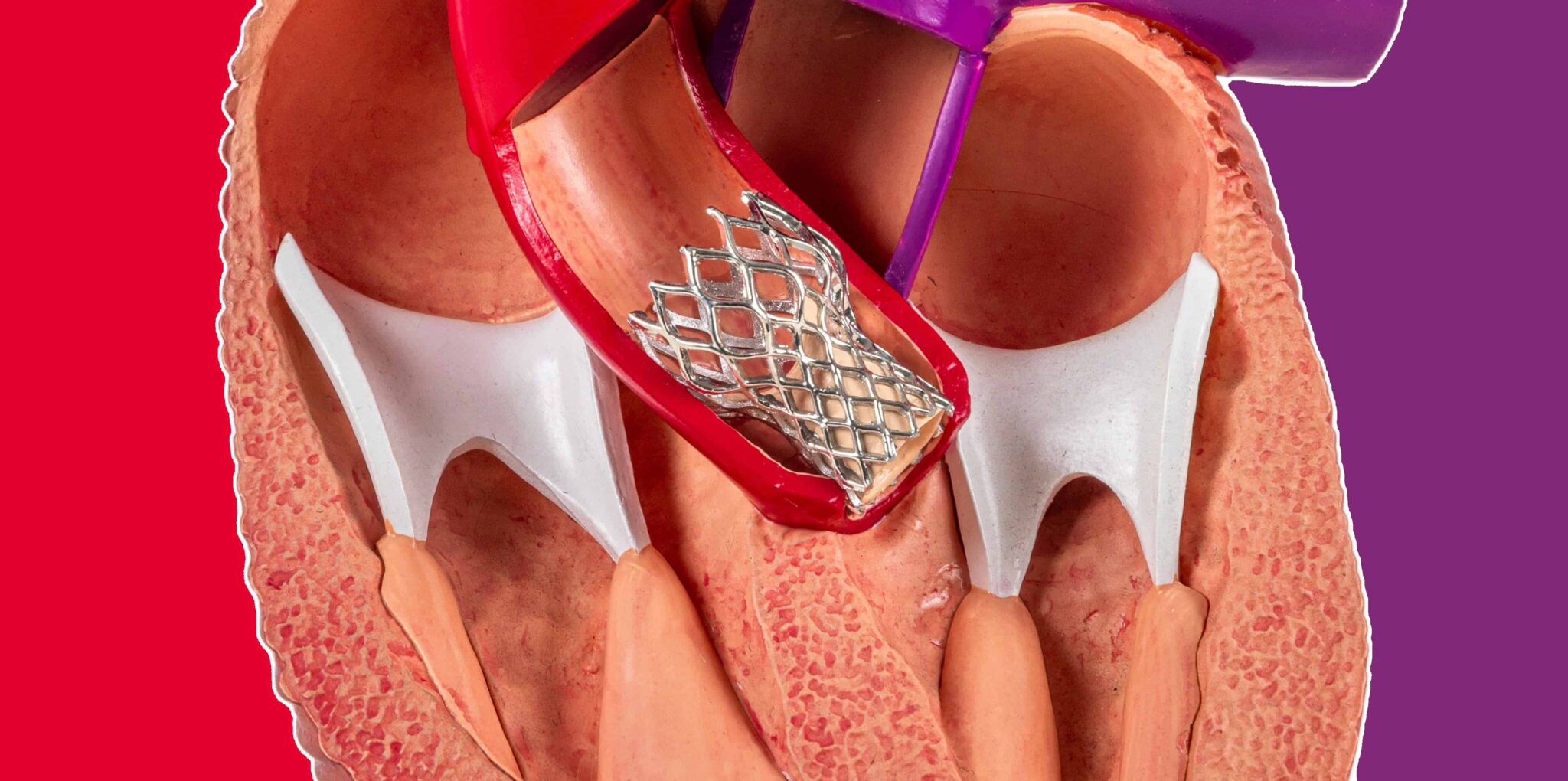 Home - Cardiac Wire