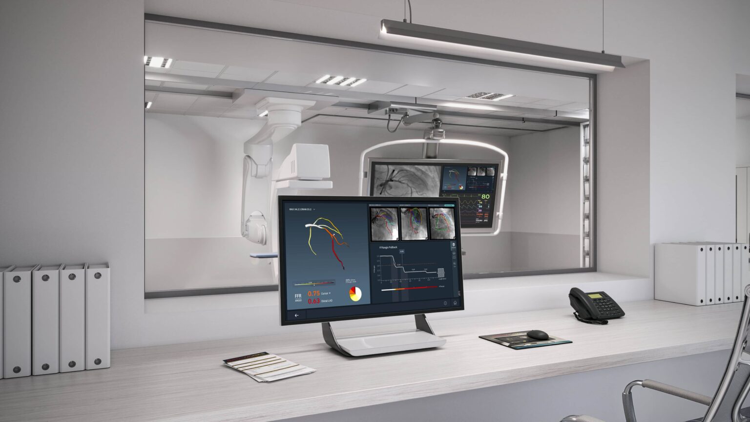 CathWorks FFRangio Goes Beyond Physiology - Cardiac Wire