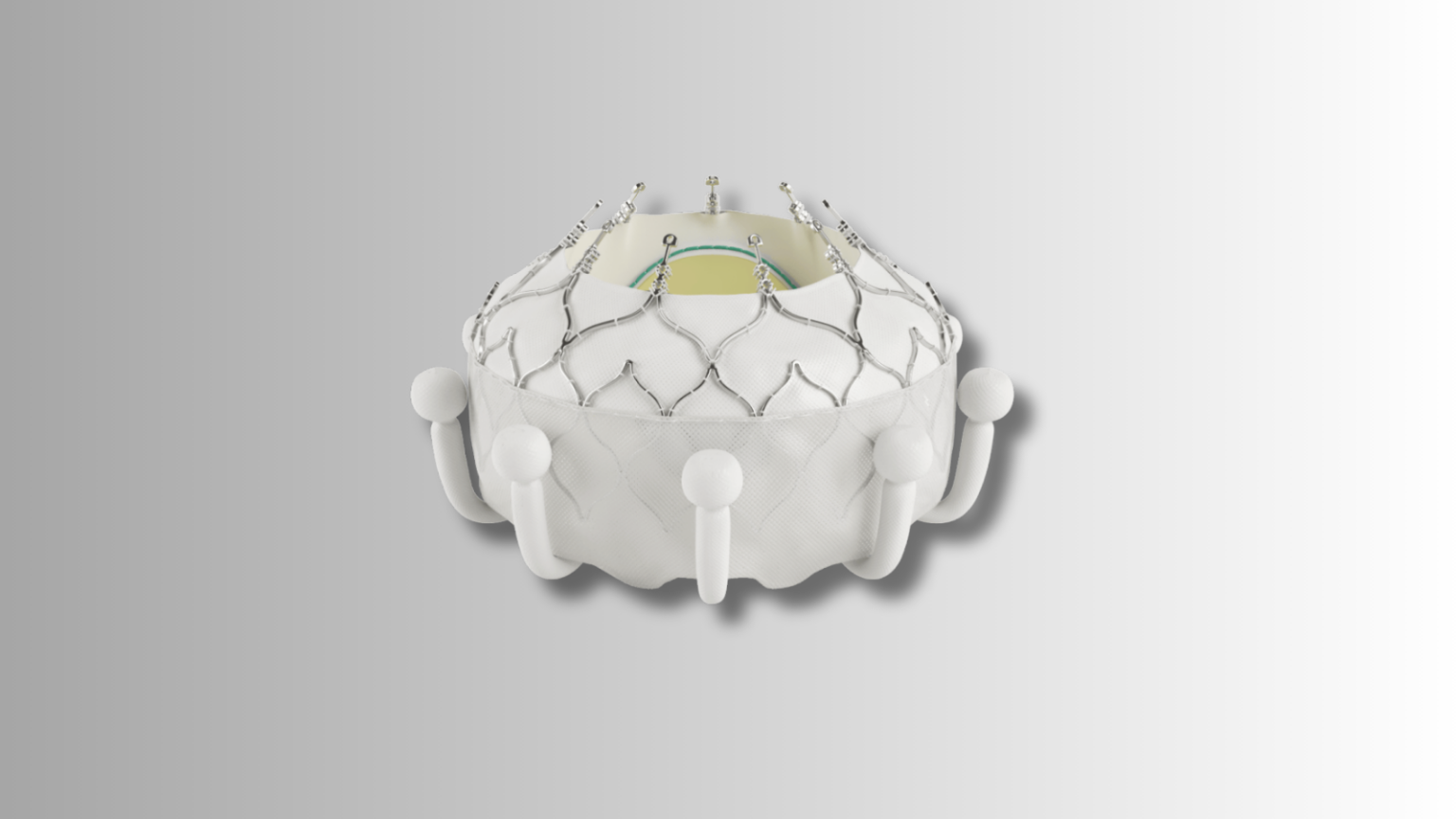 A Look Into Real-World TTVR Results - Cardiac Wire