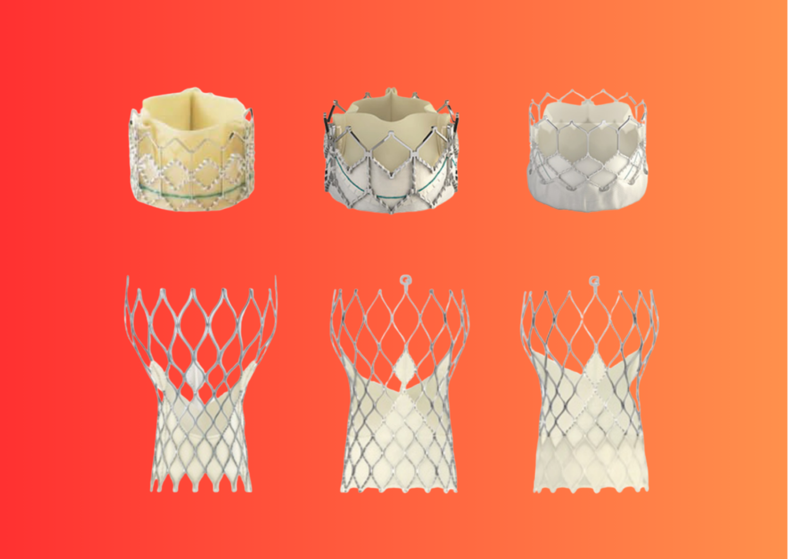 Cardiac Wire’s State of The Transcatheter Valve - Cardiac Wire